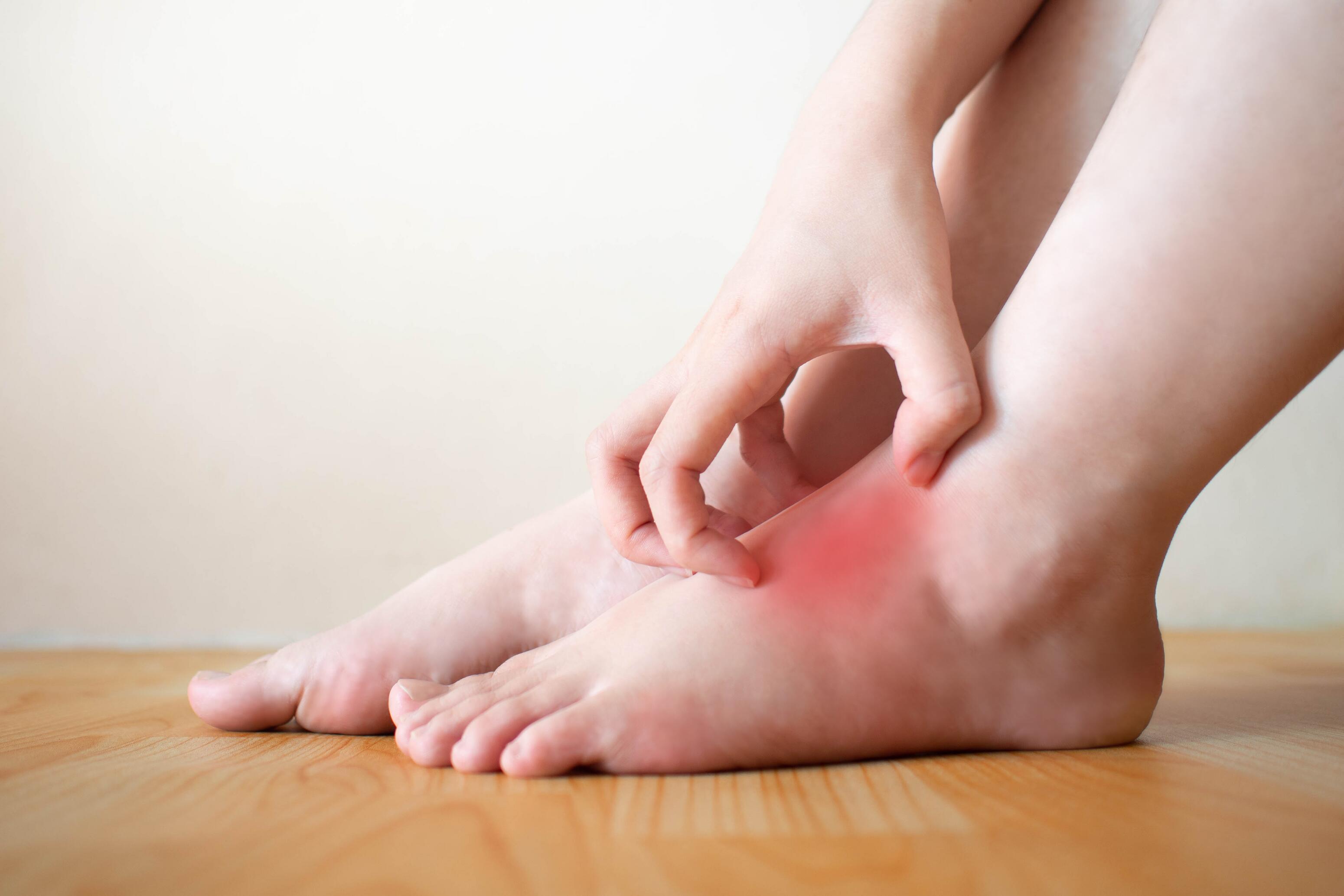 eczéma pieds atopique